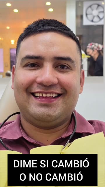 Grandes cambios con carillas - Clínica Sonrilaser Cúcuta