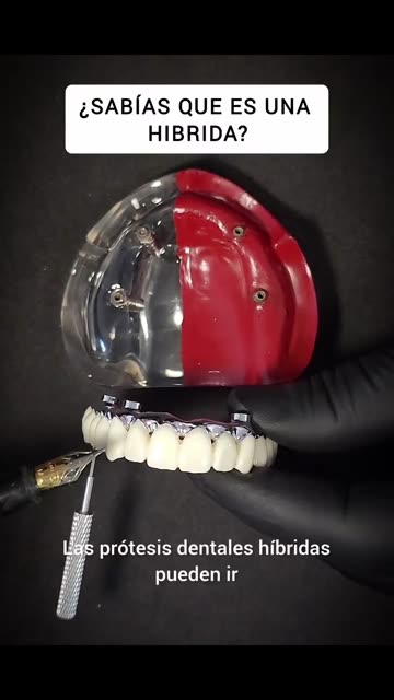 Prótesis increíbles - Clínica Sonrilaser Cúcuta