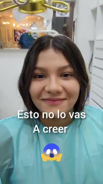 Un cambio muy positivo - Clínica Sonrilaser Cúcuta